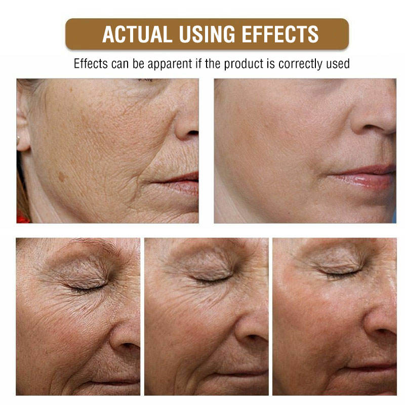 Luxury 24K Gold Snail Hyaluronic Acid Facial Serum